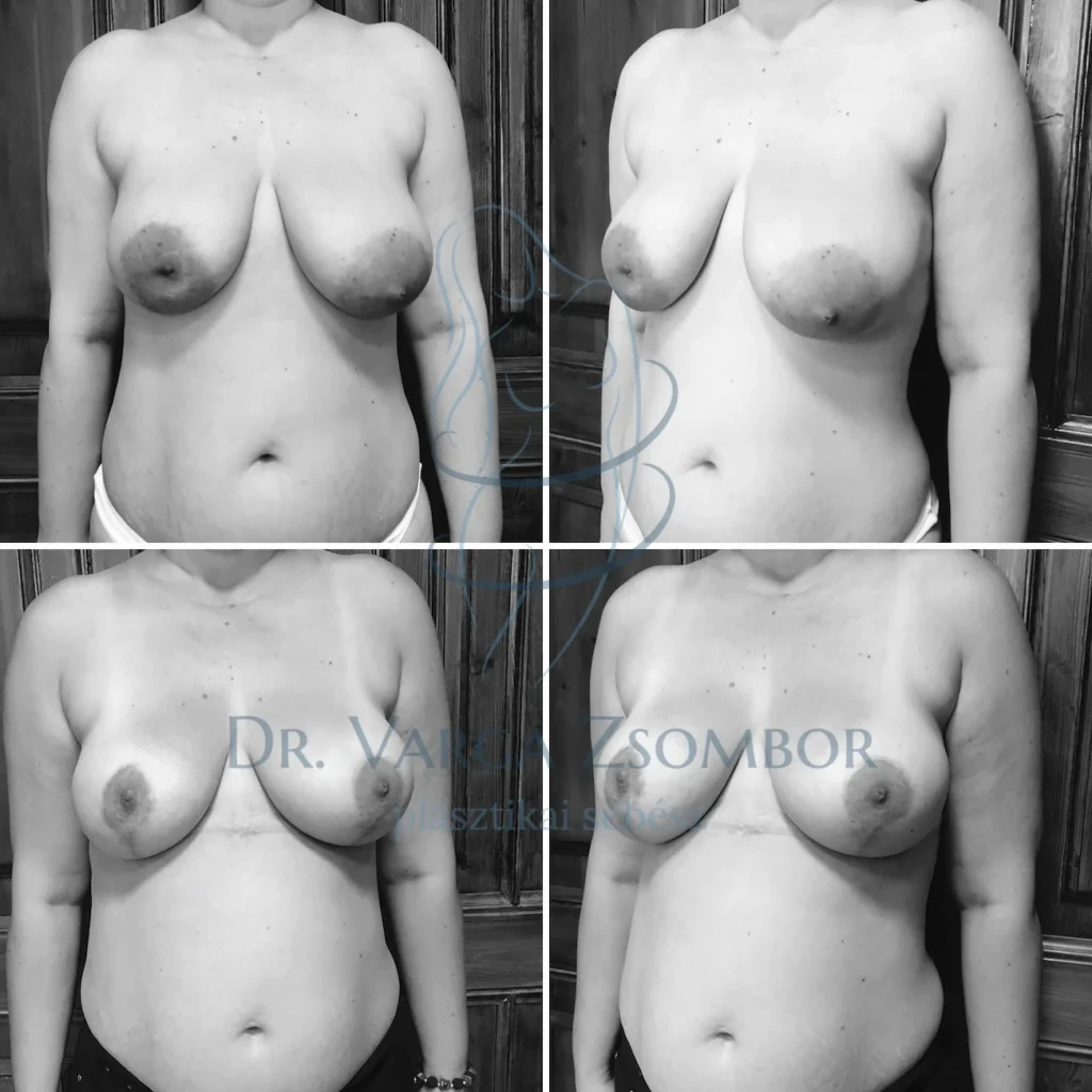 Bimbóudvar kisebbítés