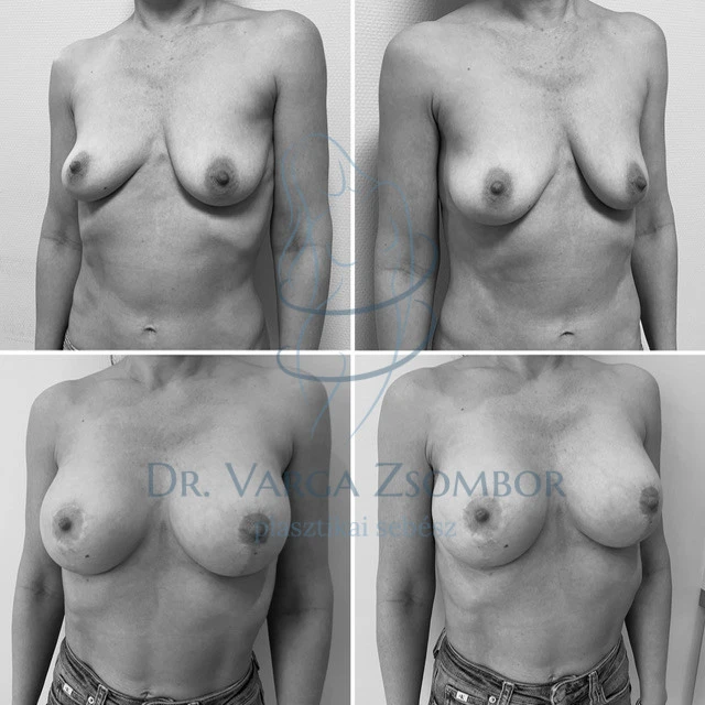 Teljes megújulás születésnapi ajándékba