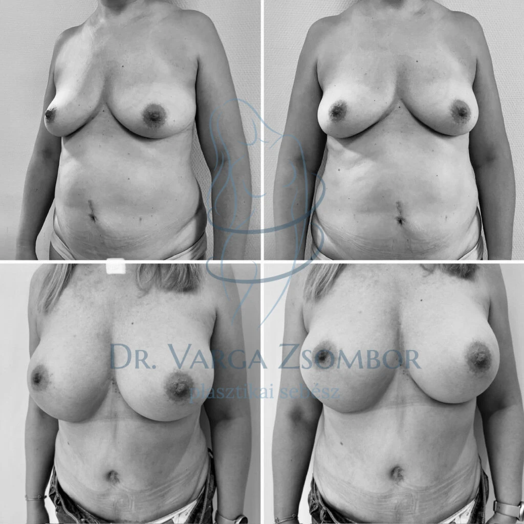 43 éves páciensünk régóta várt